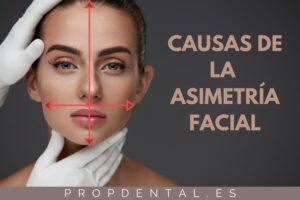 Causas de la asimetría facial Cómo arreglar la asimetría facial