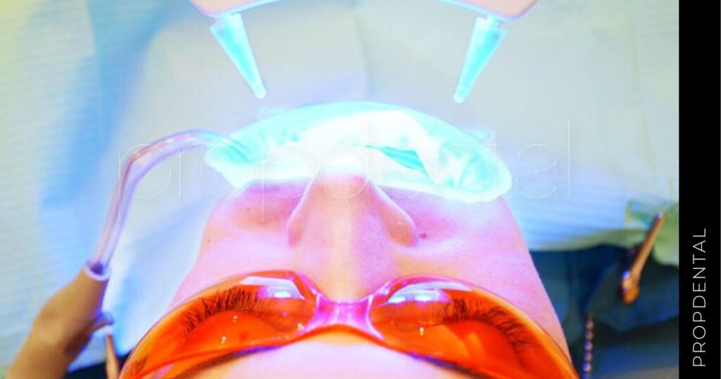 Blanqueamiento Dental Led En Barcelona Madrid Y Badalona