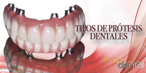 Tipos De Prótesis Dentales