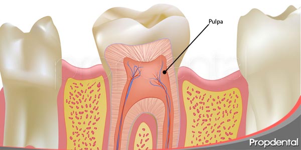 efectos-sobre-la-pulpa-despues-de-un-bla