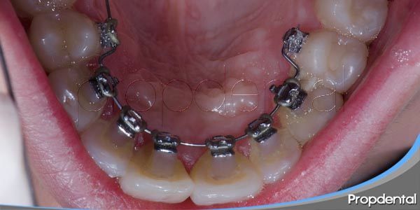 Proceso De Ortodoncia