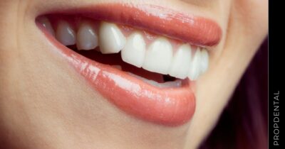 ¡Olvídate de la sonrisa gingival!