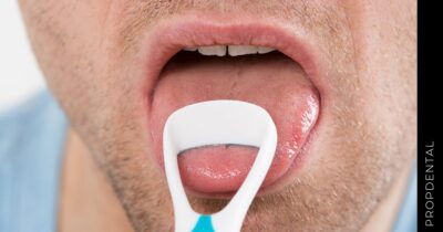 ¿Es necesario limpiar mi lengua?