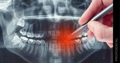 Radiografía dental: ¿Es peligrosa en embarazadas?