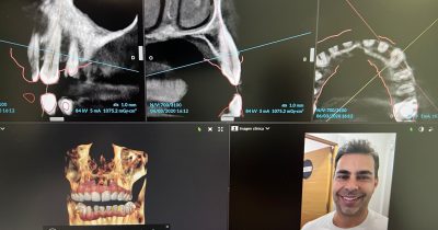 Inteligencia artificial en estética dental e implantología