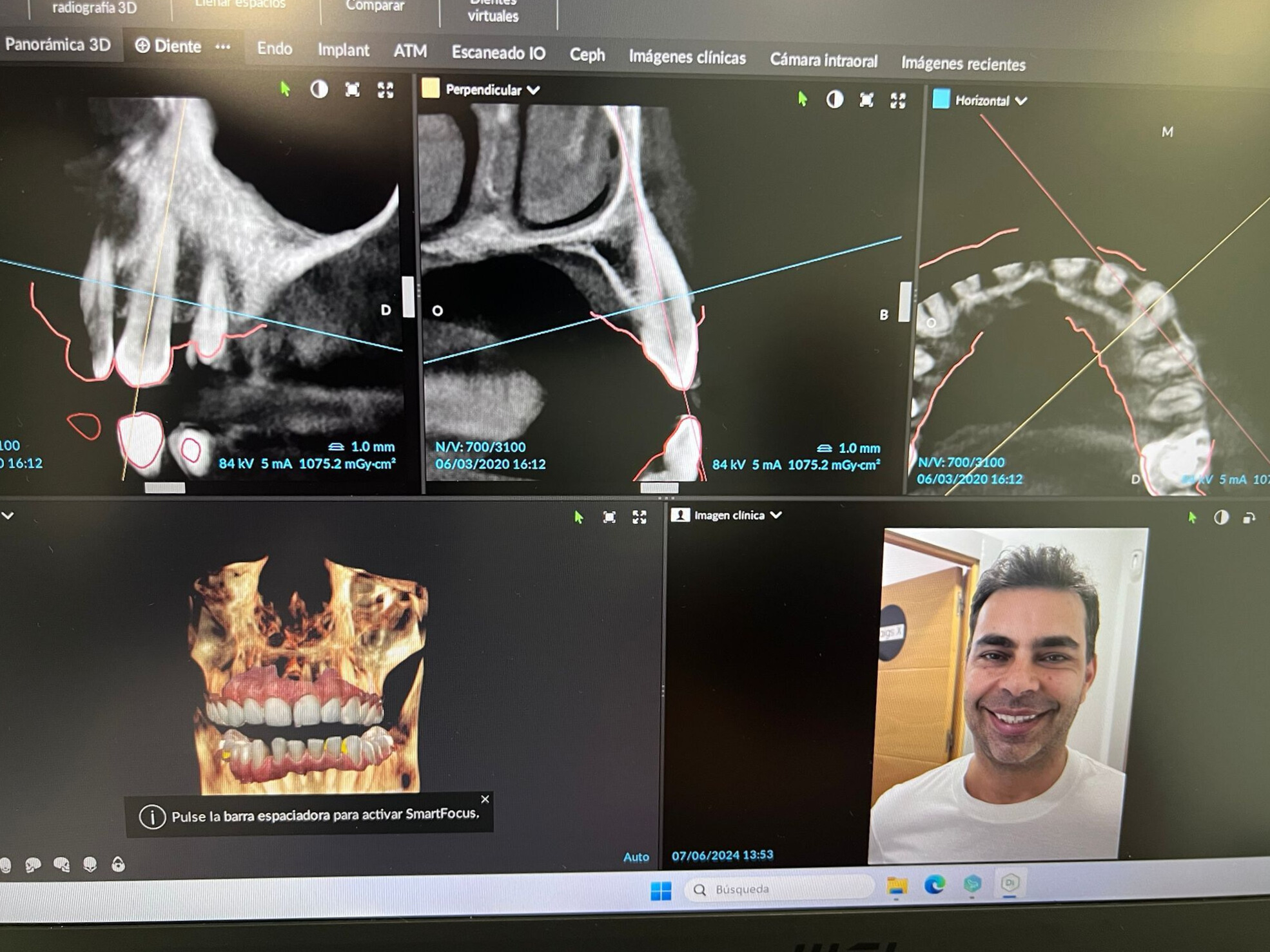 Inteligencia Artificial en odontología